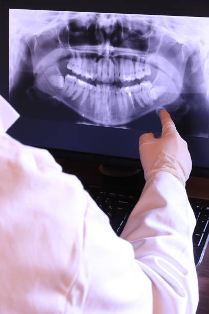 Best Emergency Wisdom Teeth Removal in Plymouth, CA